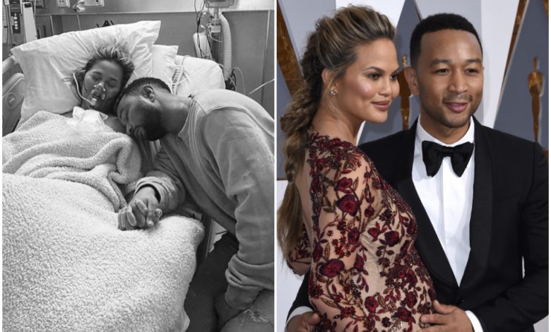 ‘My baby wouldn’t have survived’: Chrissy Teigen shared that she had to have an abortion to save her life