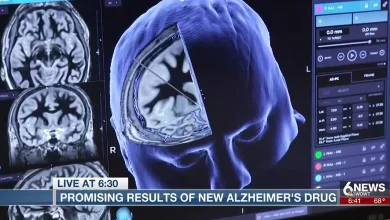 Clinical trials of Alzheimer’s drug show promising results